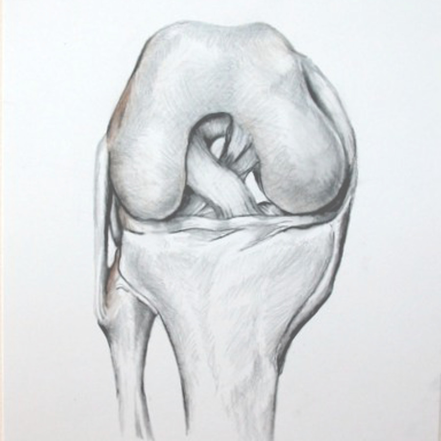 Hand-drawn anatomy illustration — knee surgery